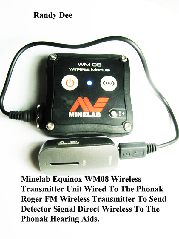 Phonak Hearing Aids & Phonak Roger Transmitter Use For Equinox ( 8 ).jpg