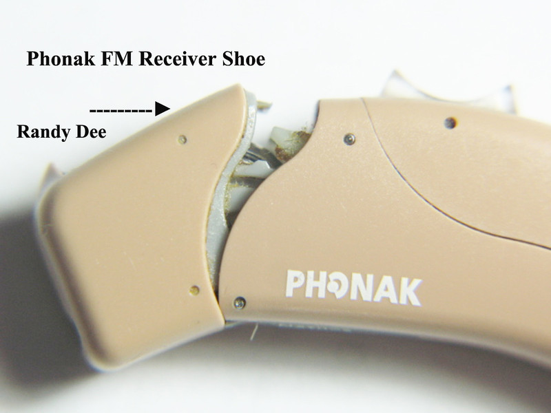 Phonak Hearing Aids & Phonak Roger Transmitter Use For Equinox ( 5 ).jpg